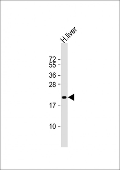 ROPN1 Antibody (Center)