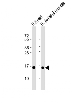 TUSC2 Antibody