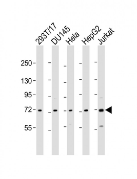 ZFP64 Antibody (C-Term)