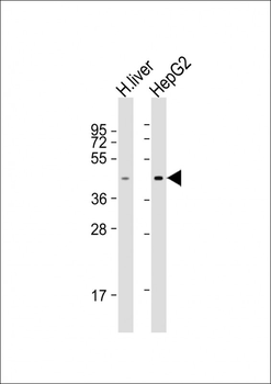 TMPRSS11D Antibody (N-Term)