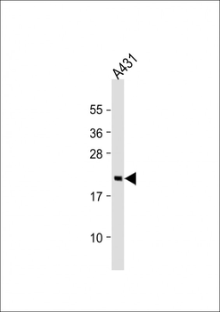 RAP2A Antibody (C-Term)