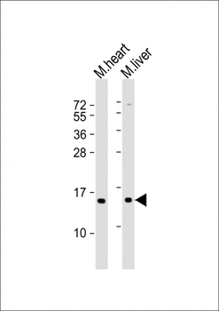 NDUFA7 Antibody (N-Term)