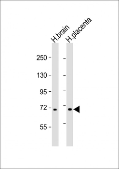 AHI1 Antibody (Center)