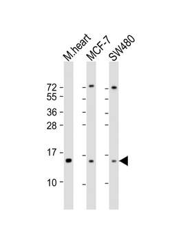 NDUFA7 Antibody (C-Term)