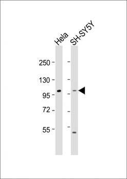 ADCY5 Antibody (Center)