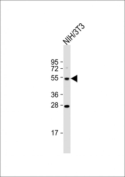 TFCP2 Antibody (Center)
