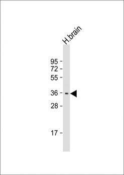 STPG1 Antibody (N-term)