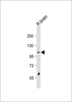 DSTYK Antibody (N-Term)