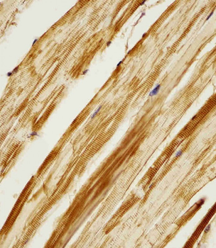 AK2 Antibody (Center)
