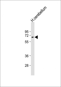 UGT2B4 Antibody (Center)