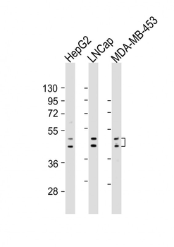 UGT2B4 Antibody (Center)