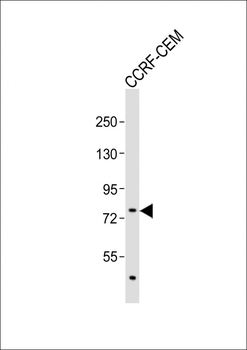 ITK Antibody (N-term)