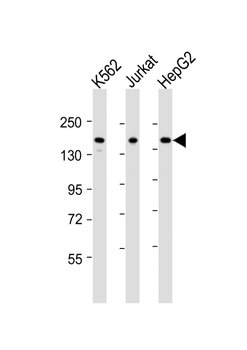 IQSEC2 Antibody (Center)