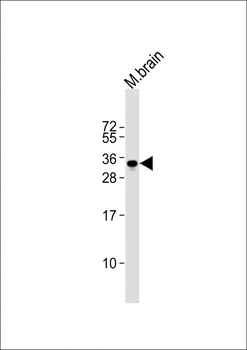 PPP1R1B Antibody (Center)