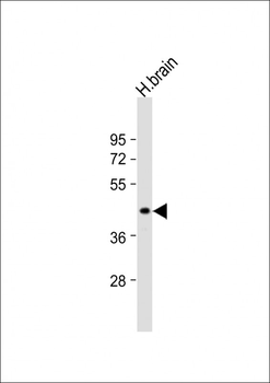 ETV1 Antibody (N-Term)