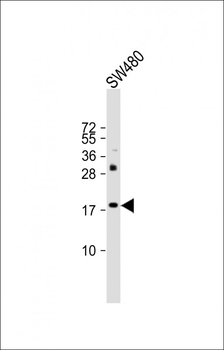 KISS1 Antibody (N-Term)