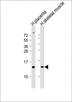 KISS1 Antibody (N-Term)