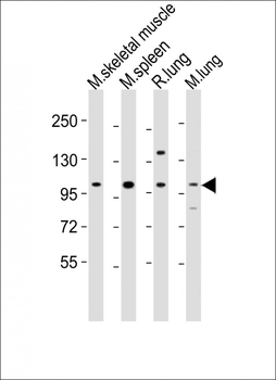 Fgfr4 Antibody (Center)