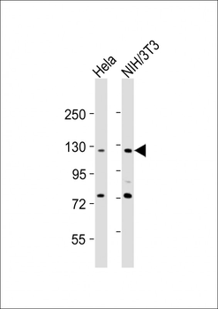 AATK Antibody (N-Term)