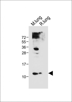 (Mouse) Hopx Antibody (Center)
