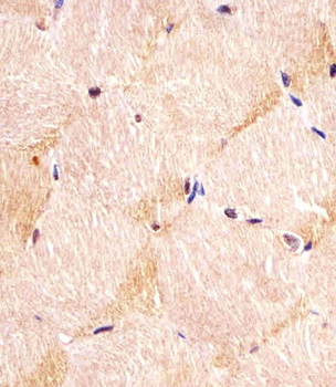 ITGA7 Antibody (N-term)