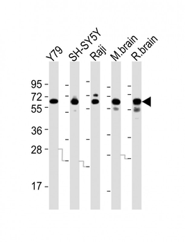 DPYSL5 Antibody (C-term)