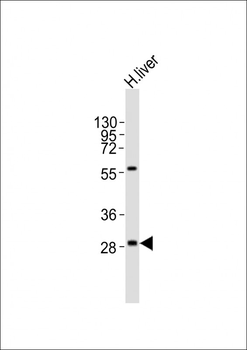 PPAP2A Antibody (C-term)