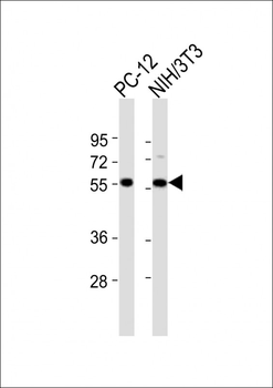 DGCR14 Antibody (C-term)