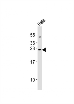 Mouse Neurog2 Antibody (C-term)