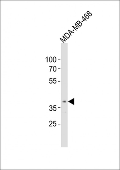 OR5A1 Antibody (C-term)