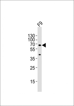 (Mouse) Gnl3 Antibody (C-term)