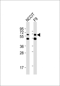 (Mouse) Gnl3 Antibody (C-term)