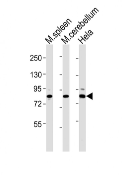 (Mouse) Suz12 Antibody (Center)