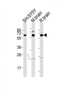 DPYSL5 Antibody (C-term)
