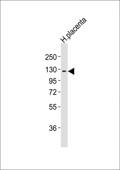 CSF1R Antibody