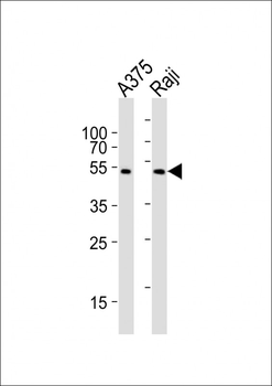 NFKBIE Antibody (Center)