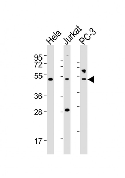 NFKBIE Antibody (Center)