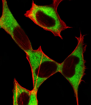 STMN2 Antibody (Center)