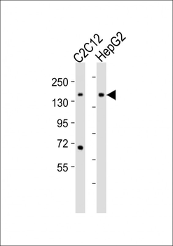 Mouse Ptk7 Antibody (C-term)