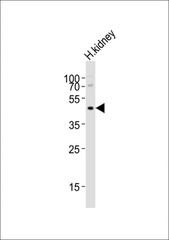 NPY2R Antibody (N-term)