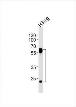 FLT1 Antibody