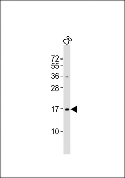 UBE2N Antibody (Center)