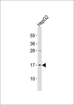 UBE2N Antibody (Center)