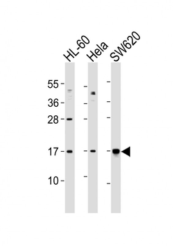 UBE2N Antibody (Center)
