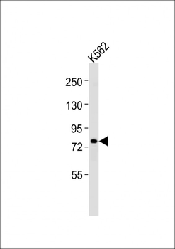 ERCC2 Antibody (C-term)