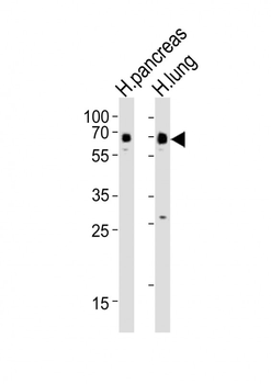SSTR1 Antibody (C-term)