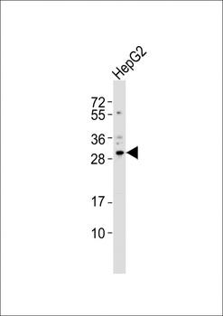 CBX7 Antibody (C-term)