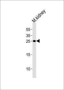 Mouse Cldn6 Antibody (C-term)
