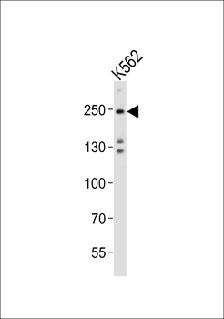 (Mouse) Dnmt1 Antibody (Center)