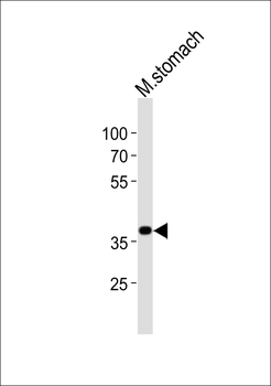 Mouse Nkx2-5 Antibody (Center)